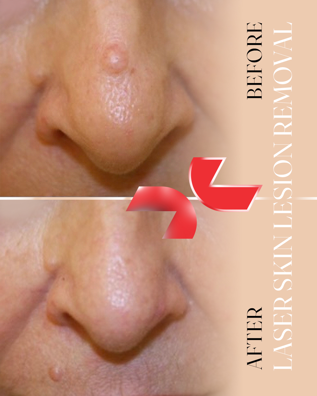 رفع ضایعات پوستی