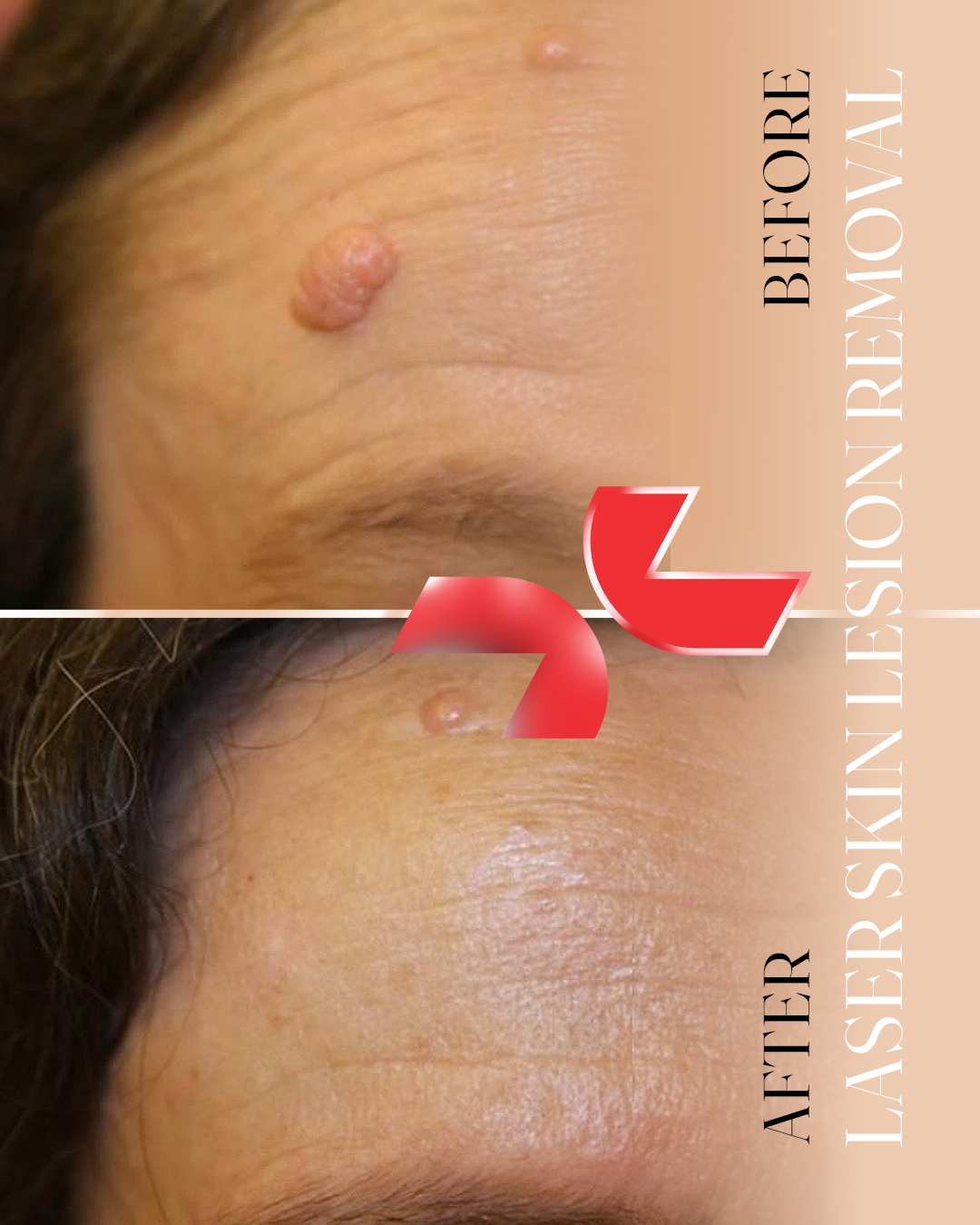 ضایعات پوستی