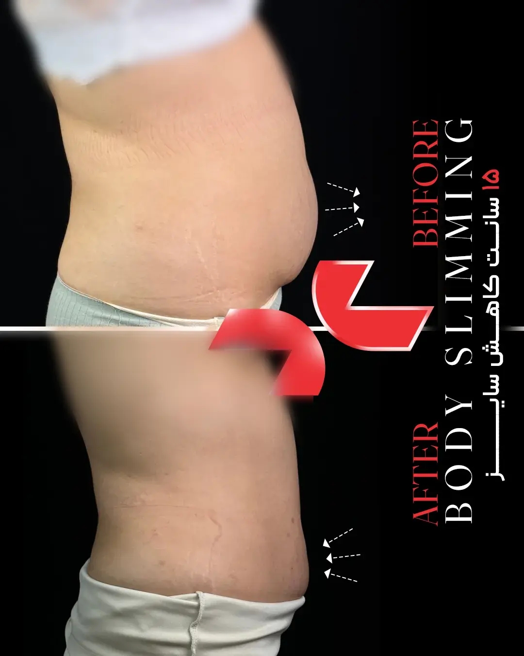 ۱۵ سانت کاهش سایز