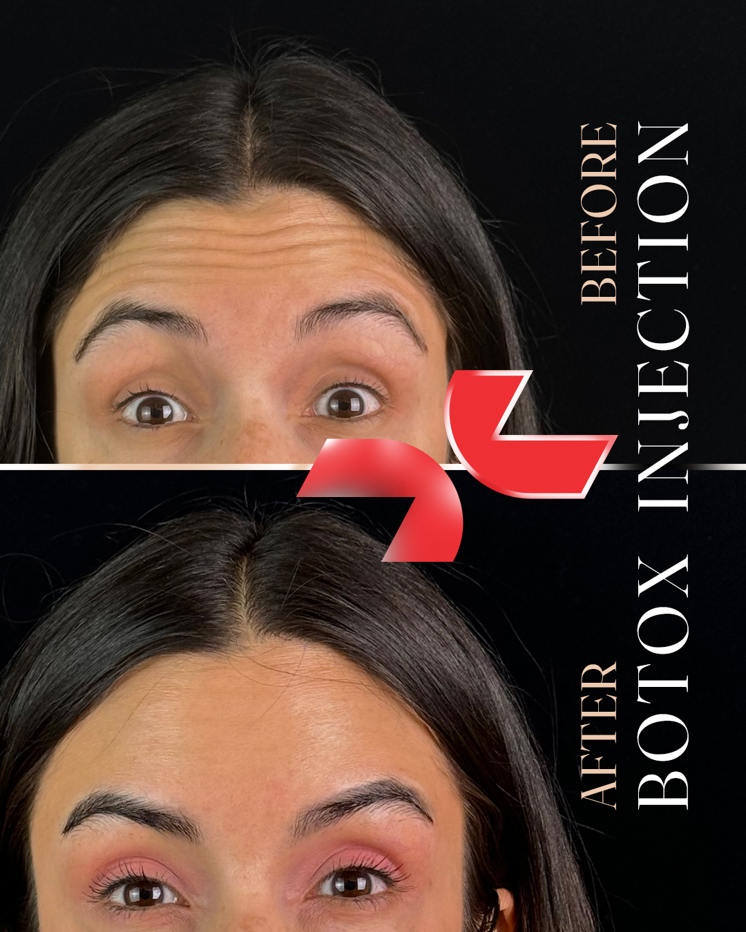 خدمات بوتاکس