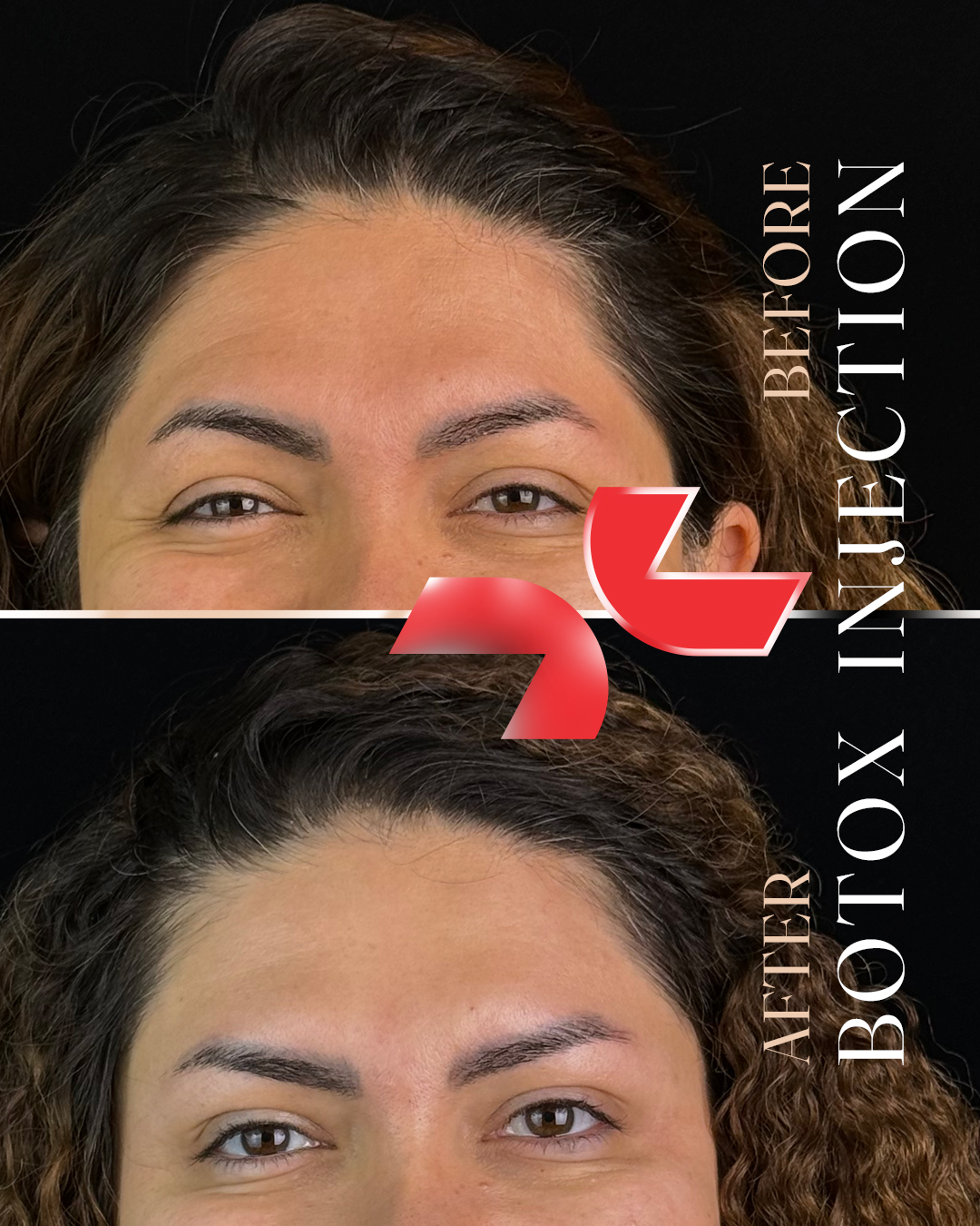 خدمات بوتاکس