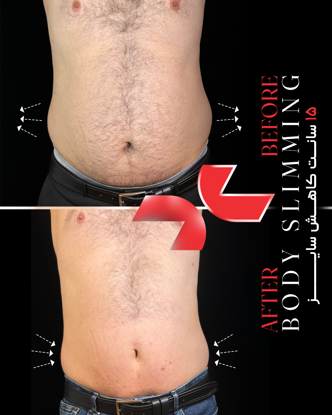 ۱۵ سانت کاهش سایز