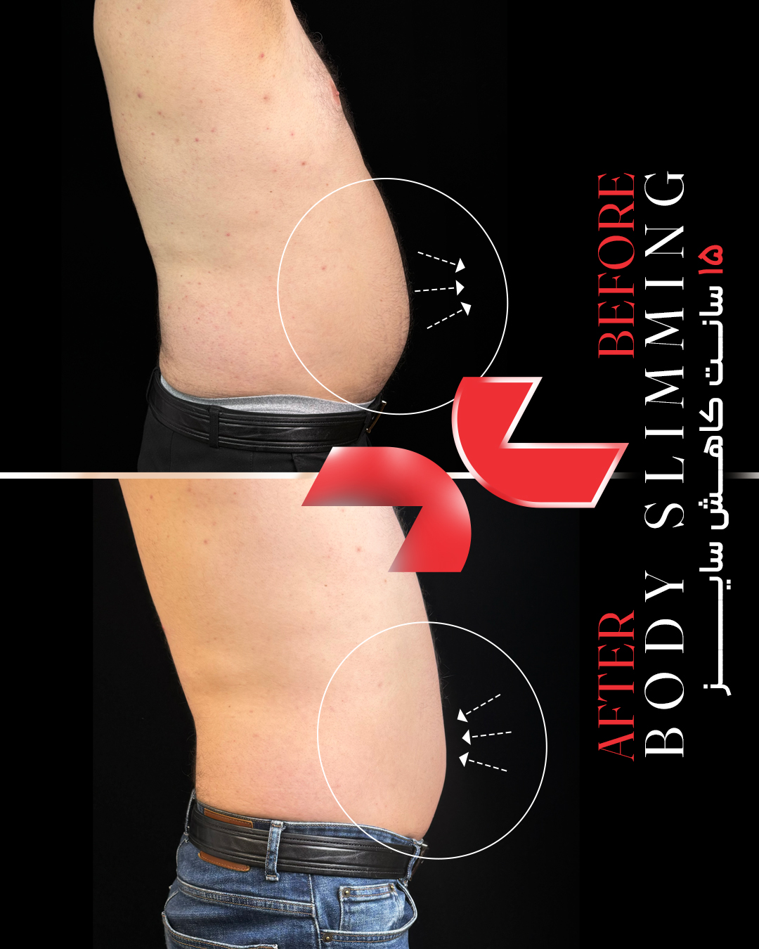 ۱۵ سانت کاهش سایز