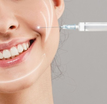 تزریق فیلر برای خط خنده؛ بهترین راهکار کدام است؟