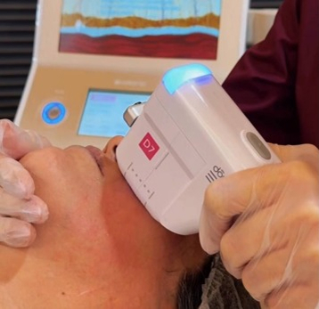 هایفو چیست و چه نقشی در جوانسازی پوست دارد؟