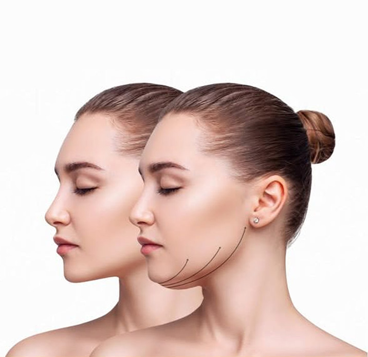 رفع غبغب با دستگاه