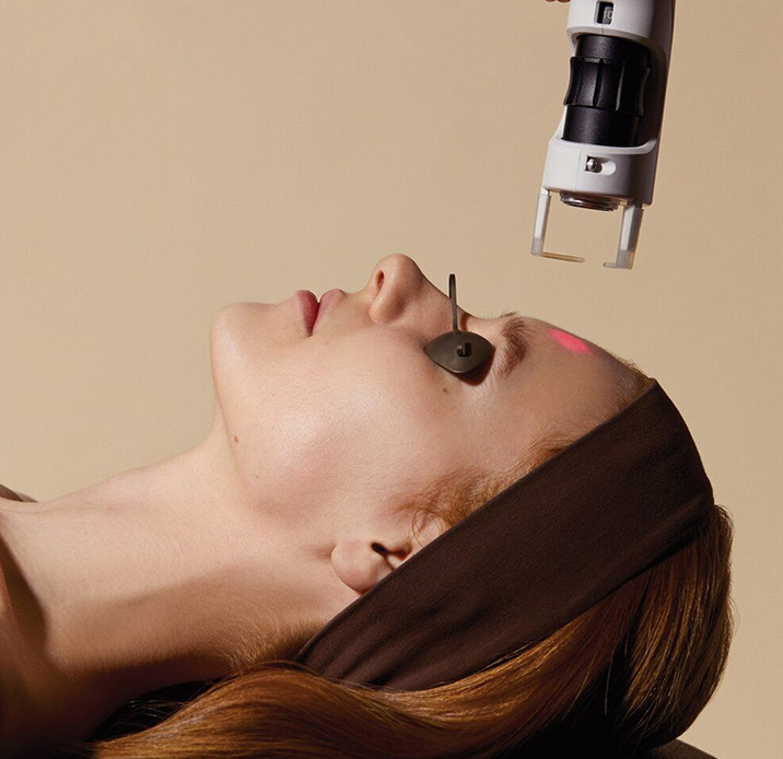 لیزر جای جوش